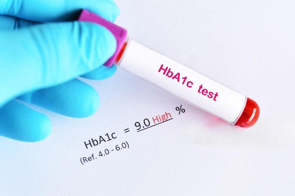Read more about the article Hemoglobin A1C (HbA1c)