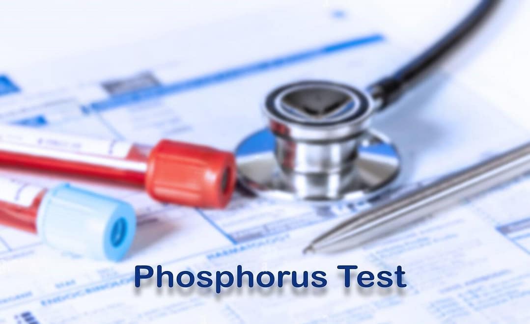 Read more about the article Inorganic Phosphorus