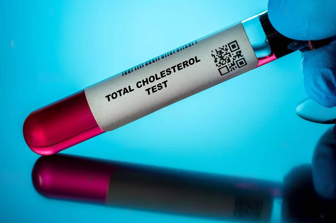 Read more about the article Total Cholesterol