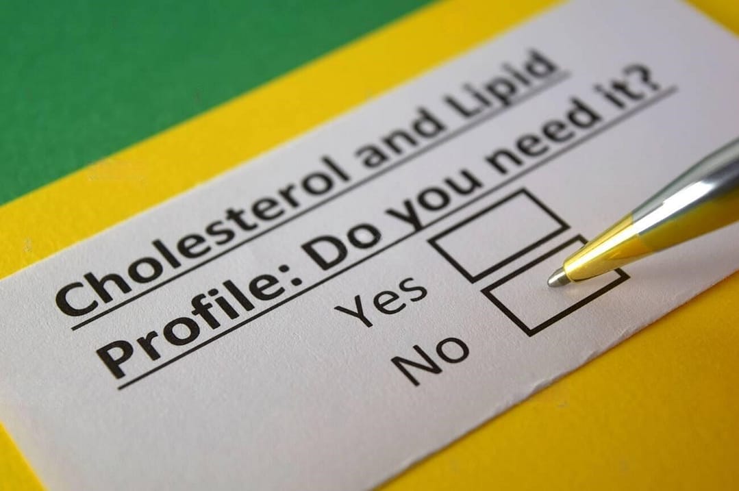 Read more about the article Lipid Profile