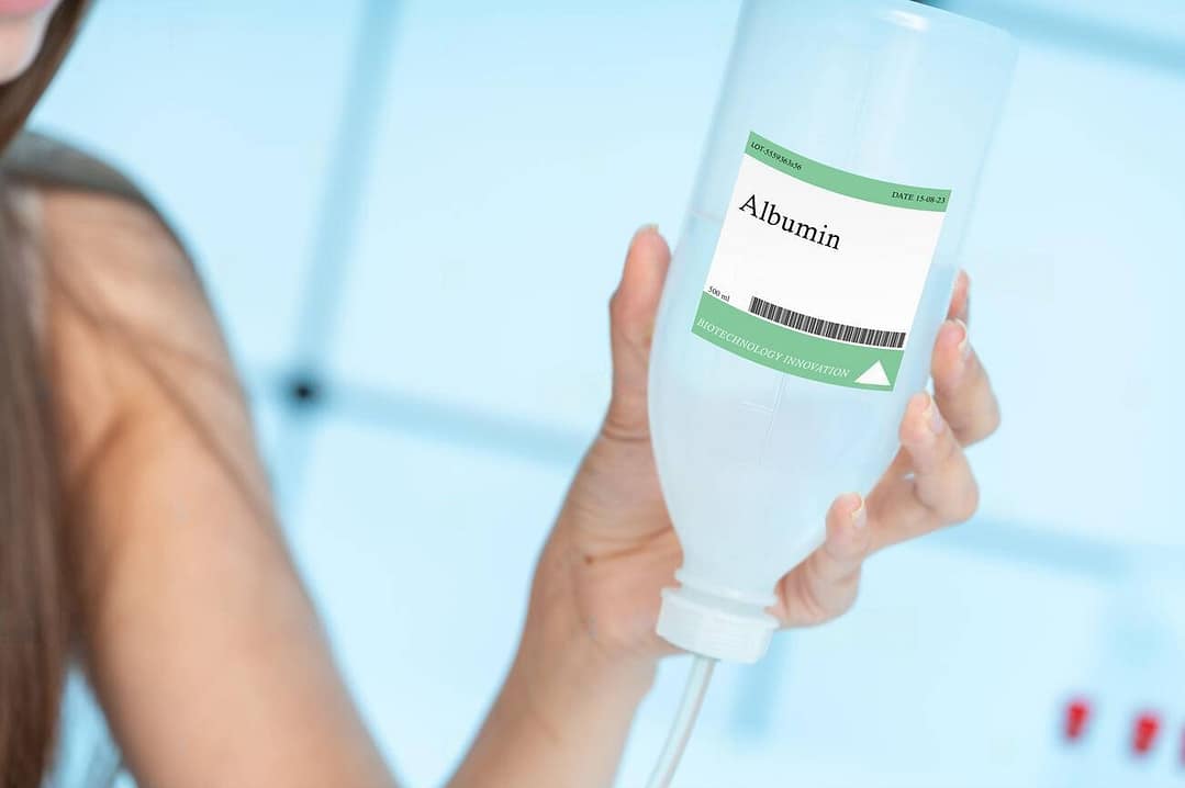 Read more about the article Albumin