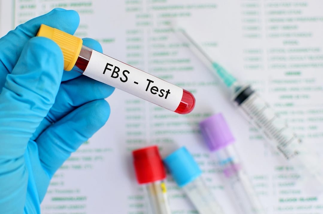 Read more about the article Fasting Blood Sugar (FBS)
