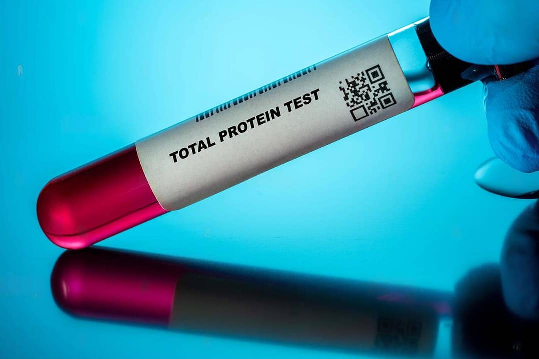 Read more about the article Total Protein and A/G Ratio