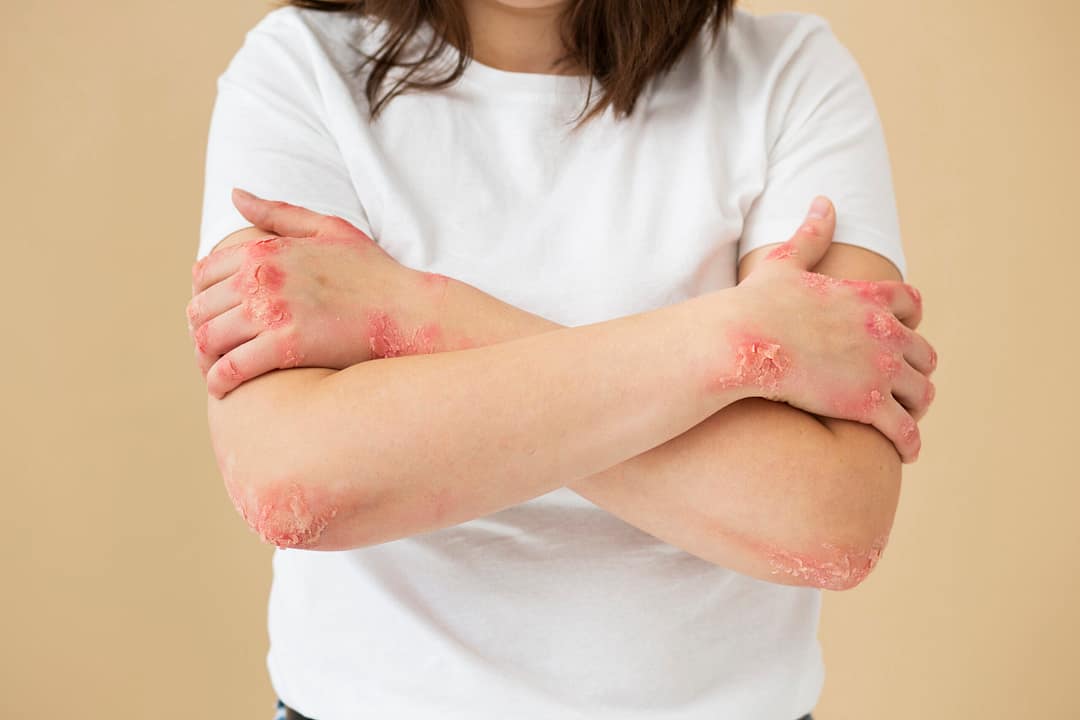 Read more about the article L.E. PREP