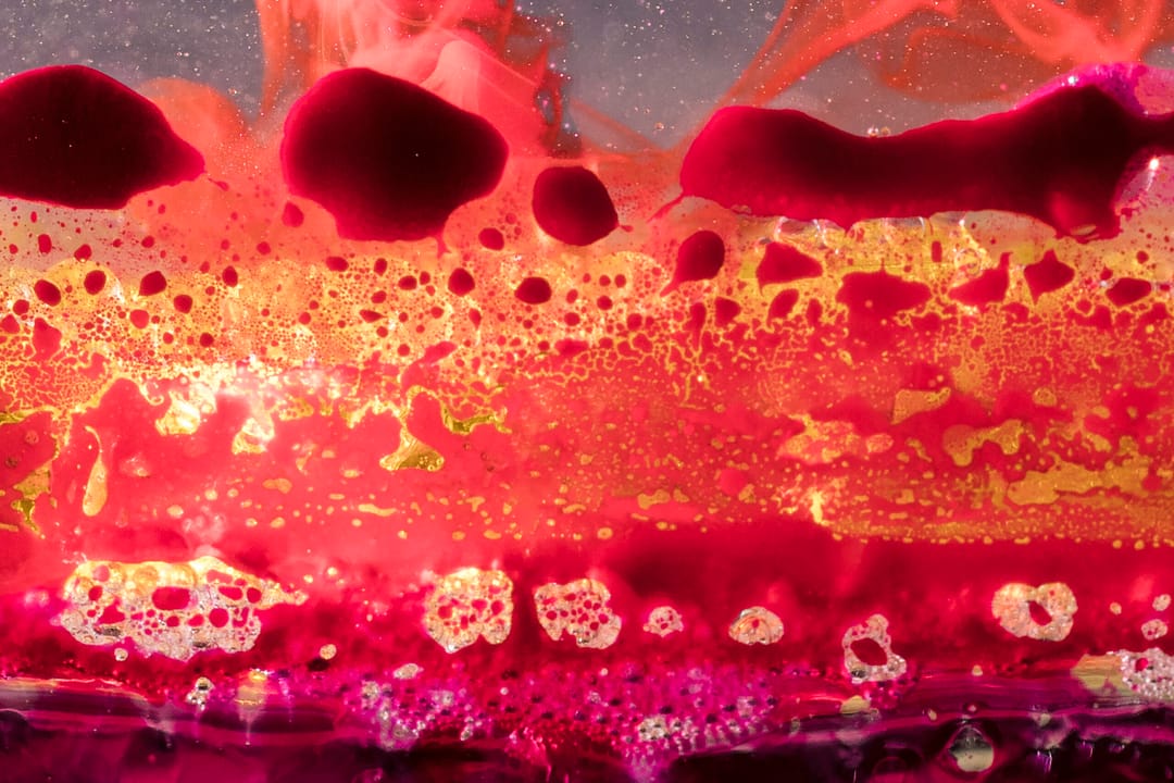 Read more about the article Fibrinogen
