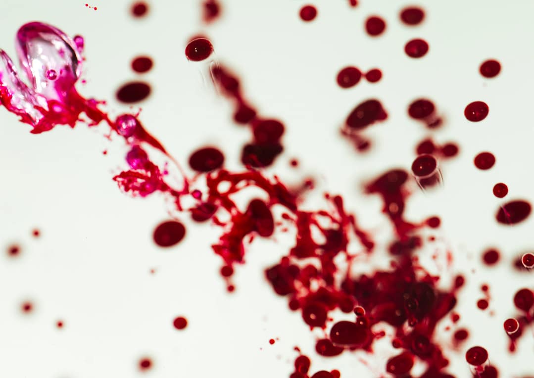 Read more about the article Peripheral Blood Smear (PBS)